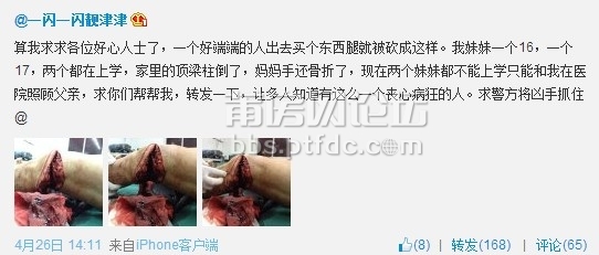 灵川男子出门被人砍断腿血腥慎入