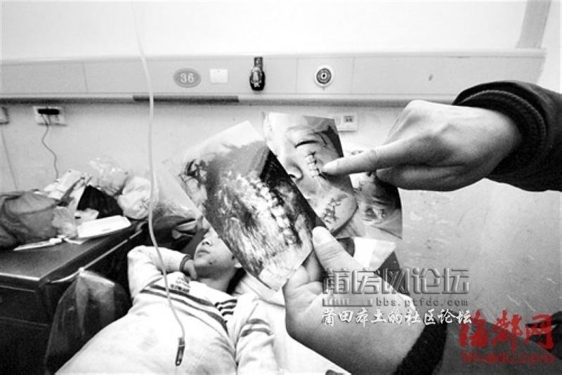 小徐的父亲拿出儿子刚做完缝合手术时拍下的照片.jpg
